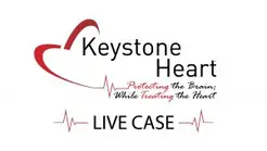Keystone Heart - Tampa, FL, USA
