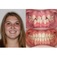 Silcox Orthodontics - Cottonwood Heights, UT, USA