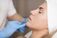 Southamptons Lip Filler Experts - Southampton, Hampshire, United Kingdom